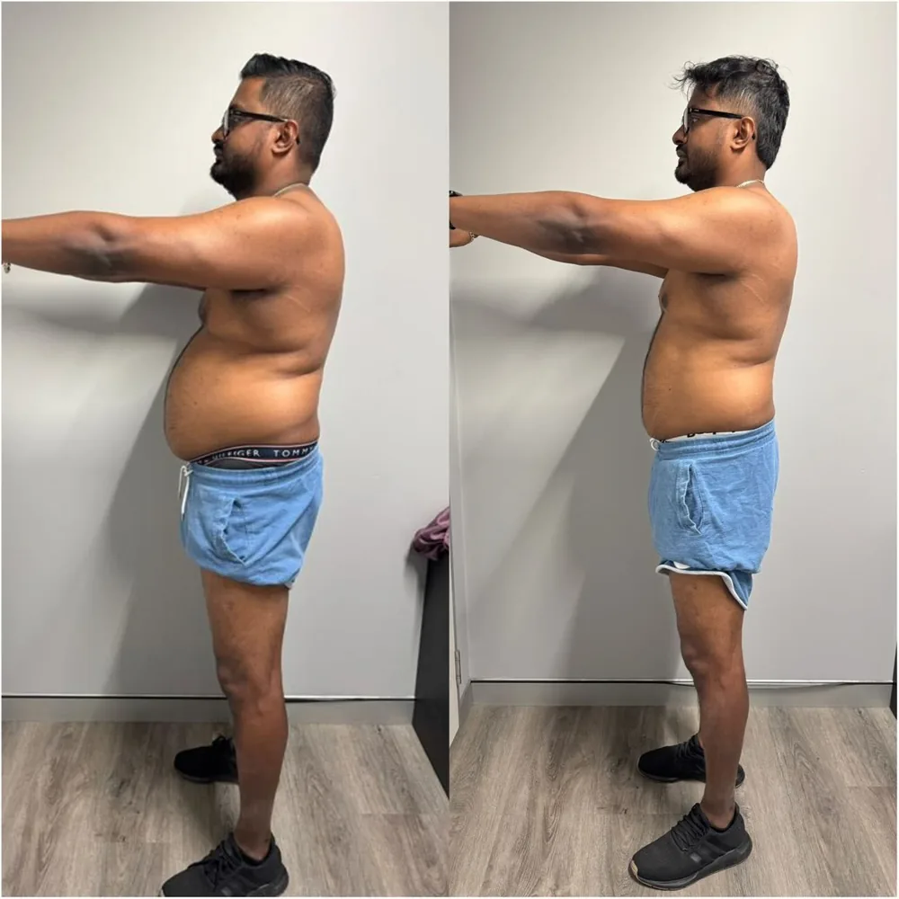 Before and after, side view: body recomposition